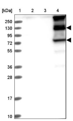 ITIH1 Antibody, Novus Biologicals 0.1mL; Unlabeled:Antibodies, Polyclonal